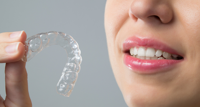 invisalign